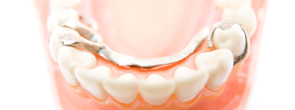 入れ歯の診療について　イメージ画像